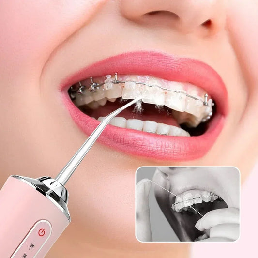 🦷IRRIGADOR DENTAL PORTÁTIL  – 🌟Cuida de tu sonrisa como un profesional 💧